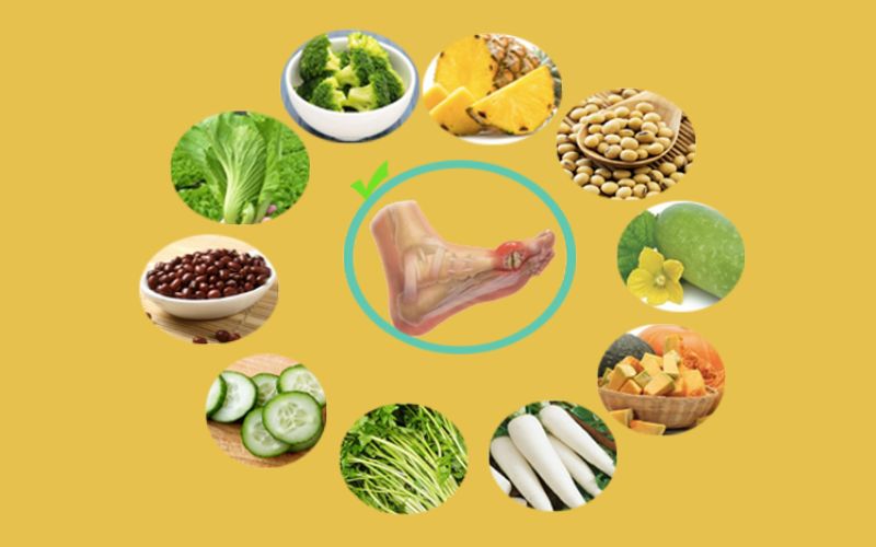 Những thực phẩm nên ăn khi bị bệnh gout