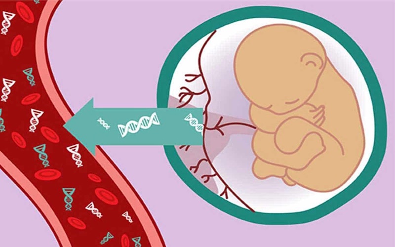 Kết quả âm tính giả NIPT là do đâu?