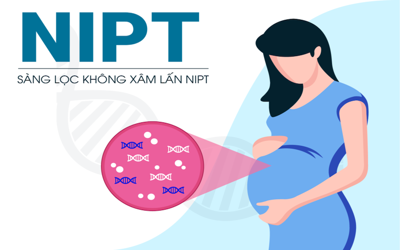 Xét nghiệm NIPT là gì?